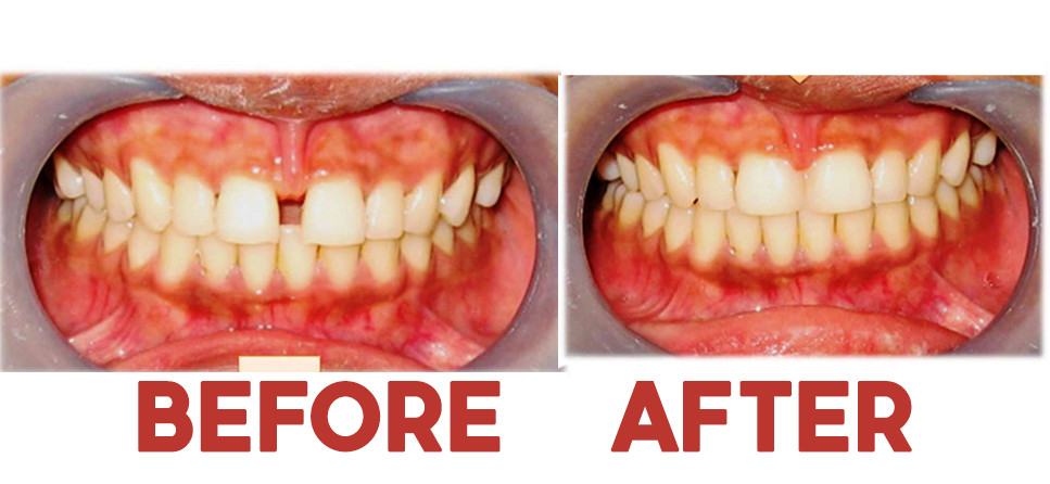 Cosmetic Dentistry
