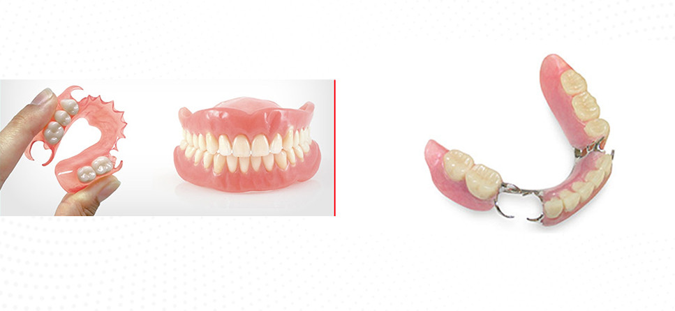 Dental Prosthesis