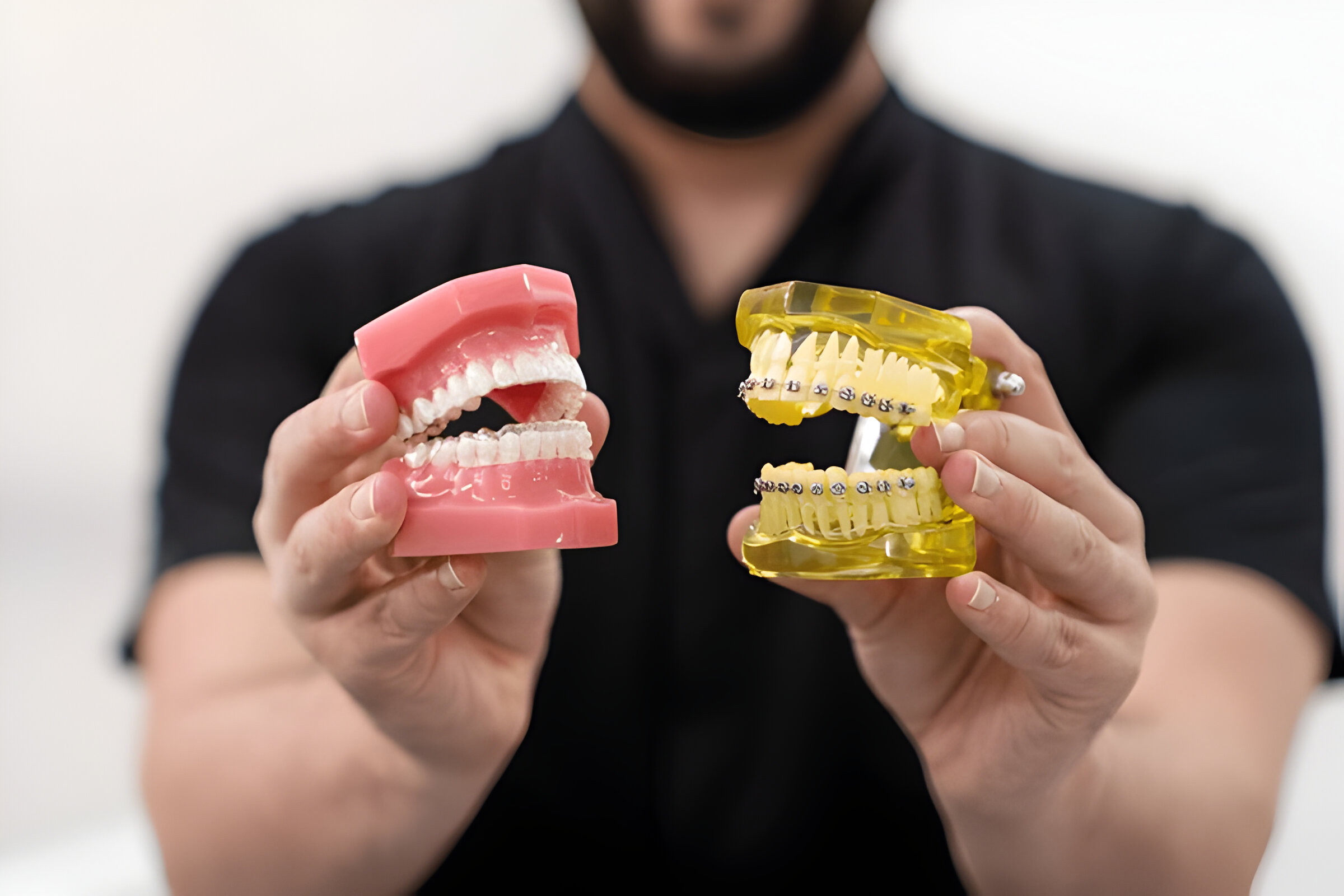 New Trends: How Trending Are Clear Aligners in Kathmandu?