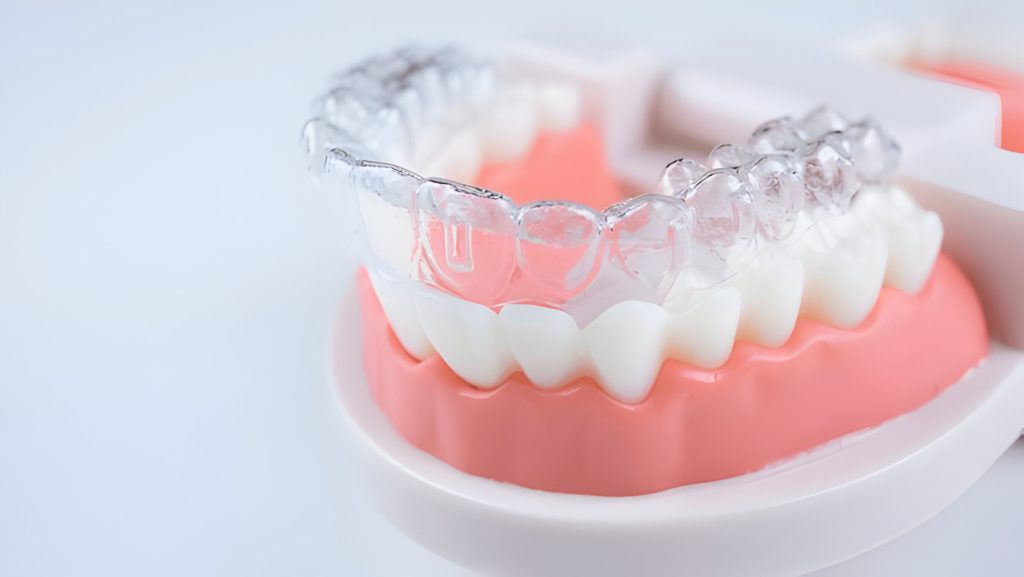 Clear Aligners in Kathmandu at Happydent Dental Clinic, Sukedhara, Hattigauda, Kapan Milanchowk