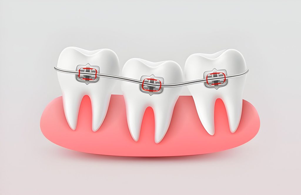 Best Orthodontic Treatment Kathmandu at Happydent Dental Kathmandu