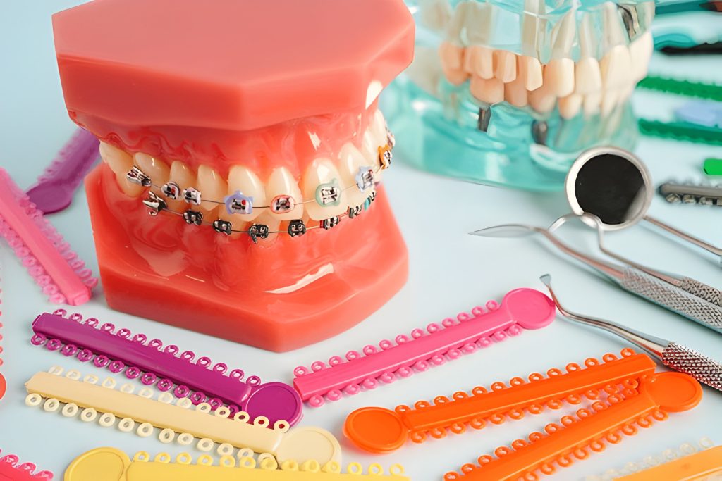 Best Orthodontic Treatment Kathmandu with Metal Braces at Happydent Dental Kathmandu