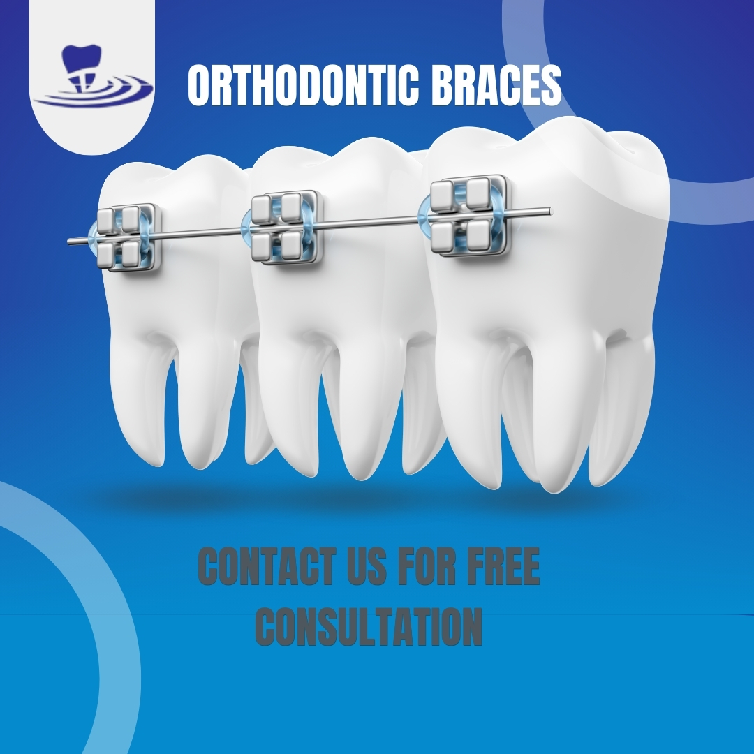 Orthodontic Treatment Made Easy: Know all about braces in brief