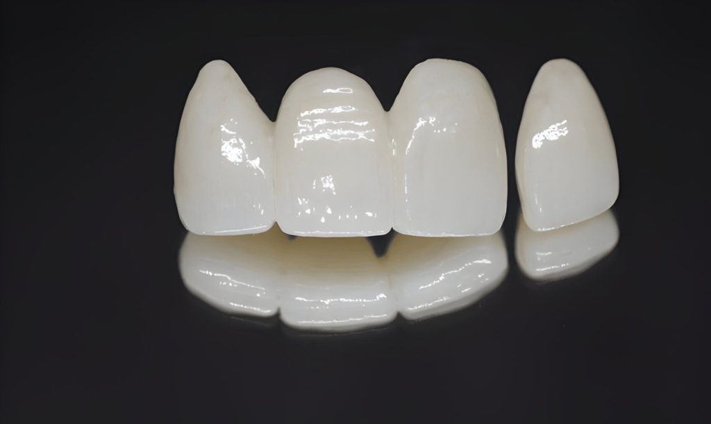 Zirconia Tooth Crown Price in Kathmandu at Happydent Dental CLinic 