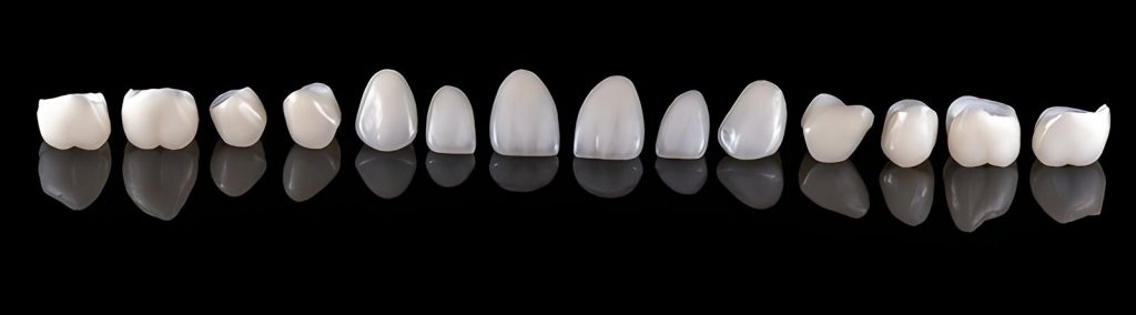 Ceramic Crown Price in Kathmandu at Happydent Dental CLinic 